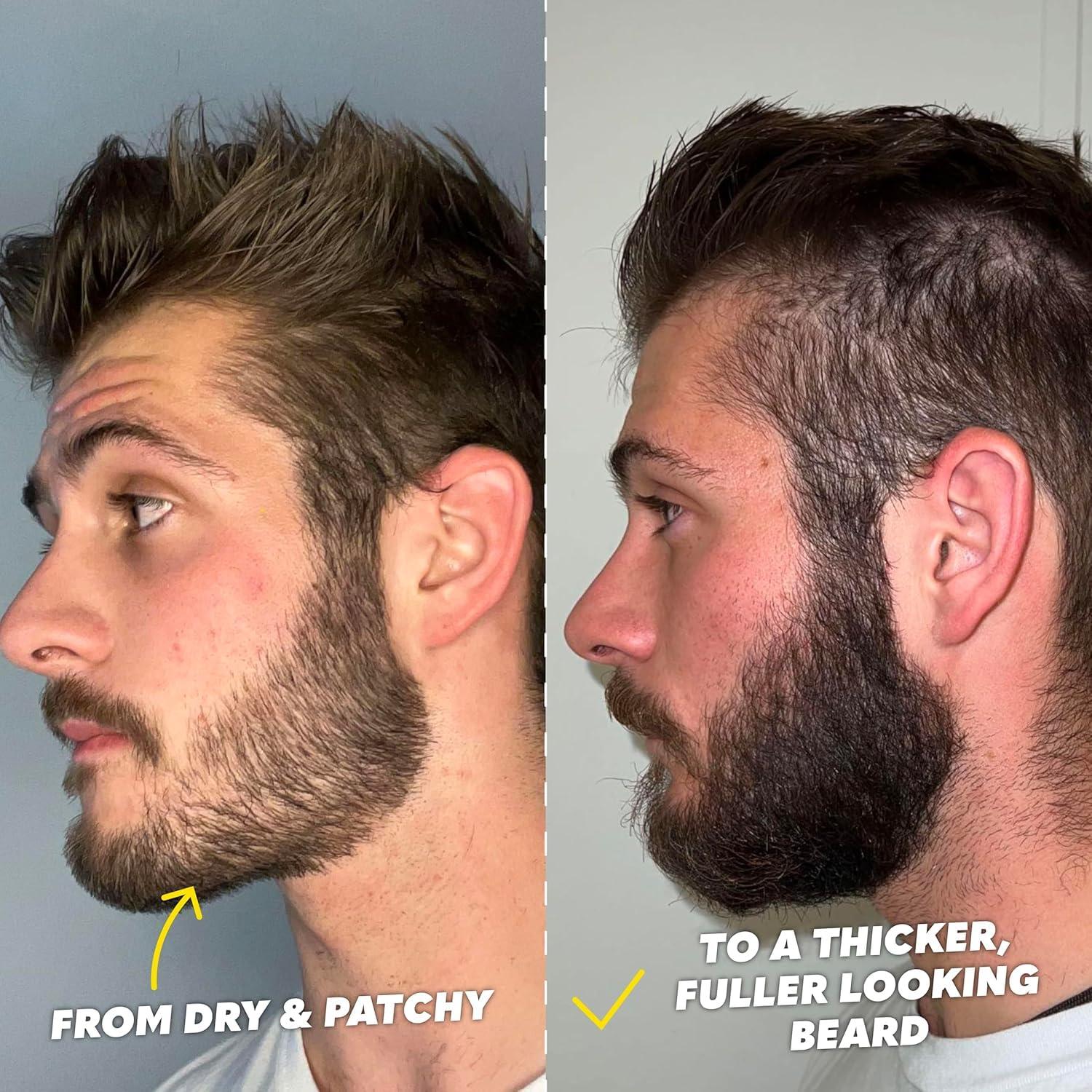 image:imageBeard Club Premium Beard Growth Kit Growth Oil Vitamins Vitamin Spray amp Boar Bristle Brush Gift SetSupreme Beard Growth Kit