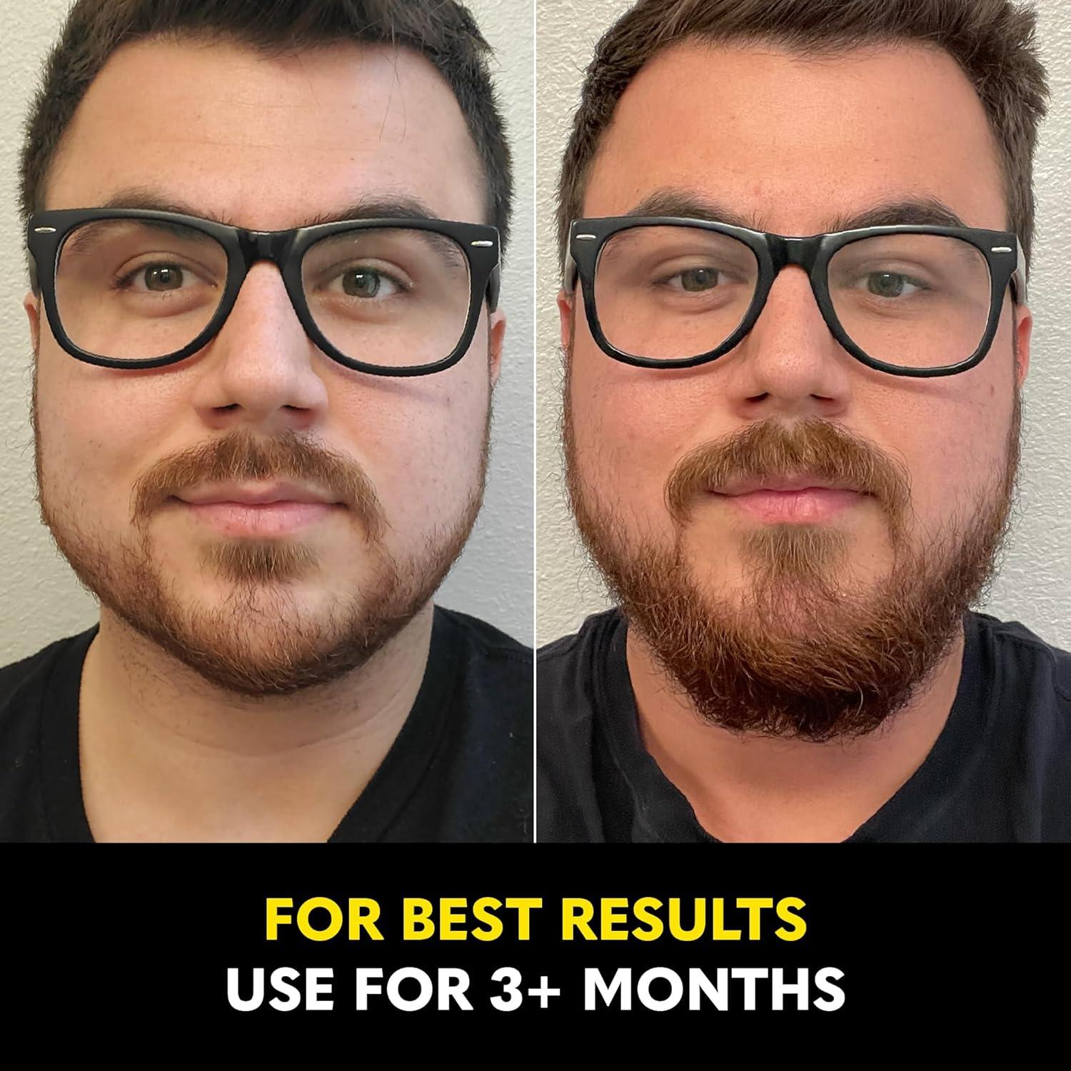 image:imageThe Beard Club Biotin Beard Growth Oil Vitamin Spray for Facial Hair Growth Natural Formula for Fuller Thicker Beard EasytoUse Nourishing amp Soothing for All Beard Types amp SkinGrowth Vitamins